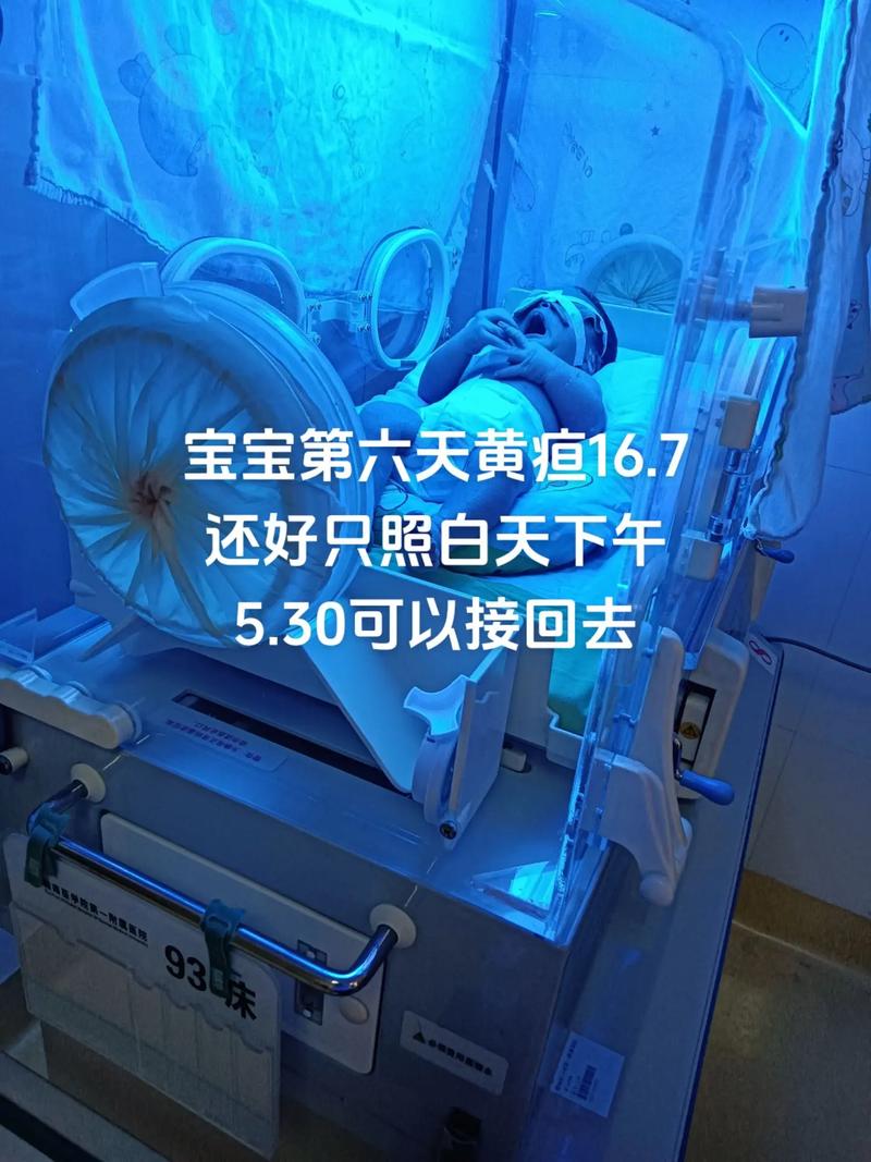 新生儿6天黄疸值18mg/dl需要立即干预吗？会对脑部有影响吗？-第1张图片-郑州医学网