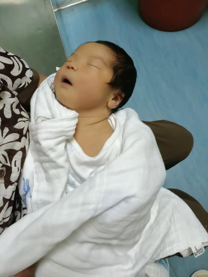 新生儿6天黄疸值18mg/dl需要立即干预吗？会对脑部有影响吗？-第2张图片-郑州医学网