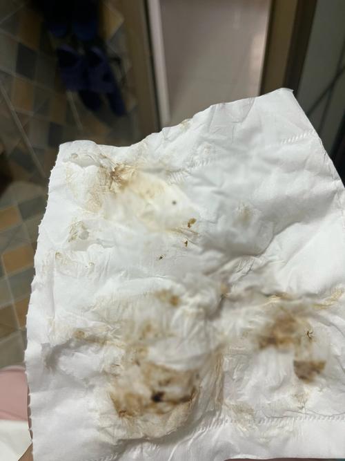 怀孕期间白带呈咖啡色是正常现象还是异常信号？-第3张图片-郑州医学网