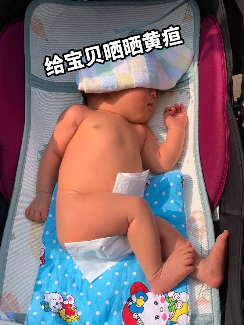 新生儿 黄疸 葡萄糖-第2张图片-郑州医学网