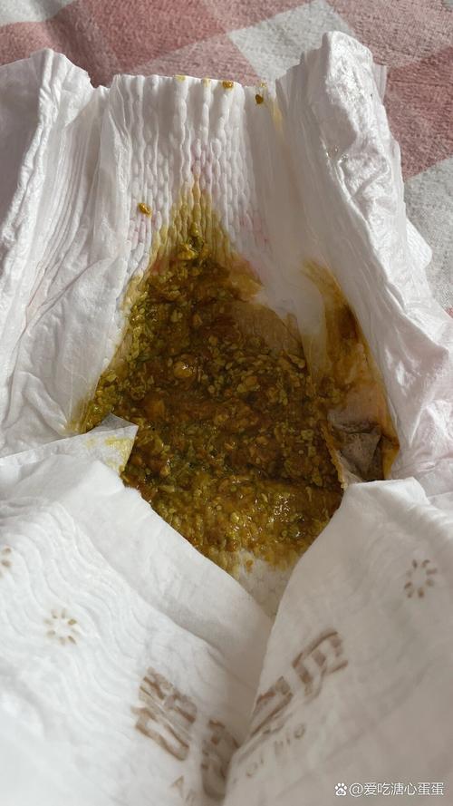 新生儿吐奶吐的是奶瓣-第1张图片-郑州医学网