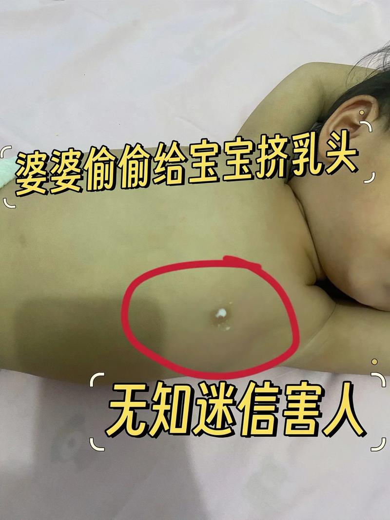 8岁儿童乳房出现乳核是性早熟信号吗？家长该如何科学应对？-第3张图片-郑州医学网