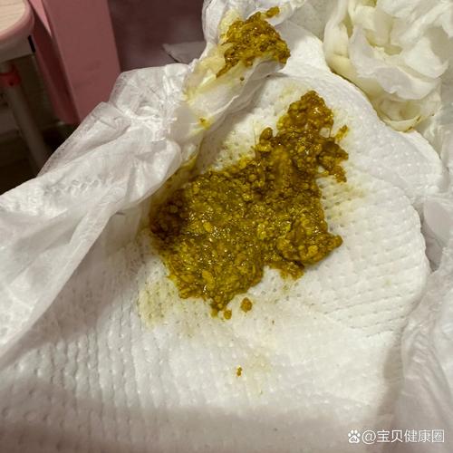 新生儿第二天没有便便-第2张图片-郑州医学网