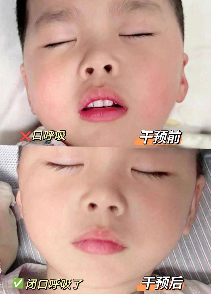 新生儿呼吸时头部轻微一点一点是正常现象吗？需要警惕哪些异常情况？-第1张图片-郑州医学网