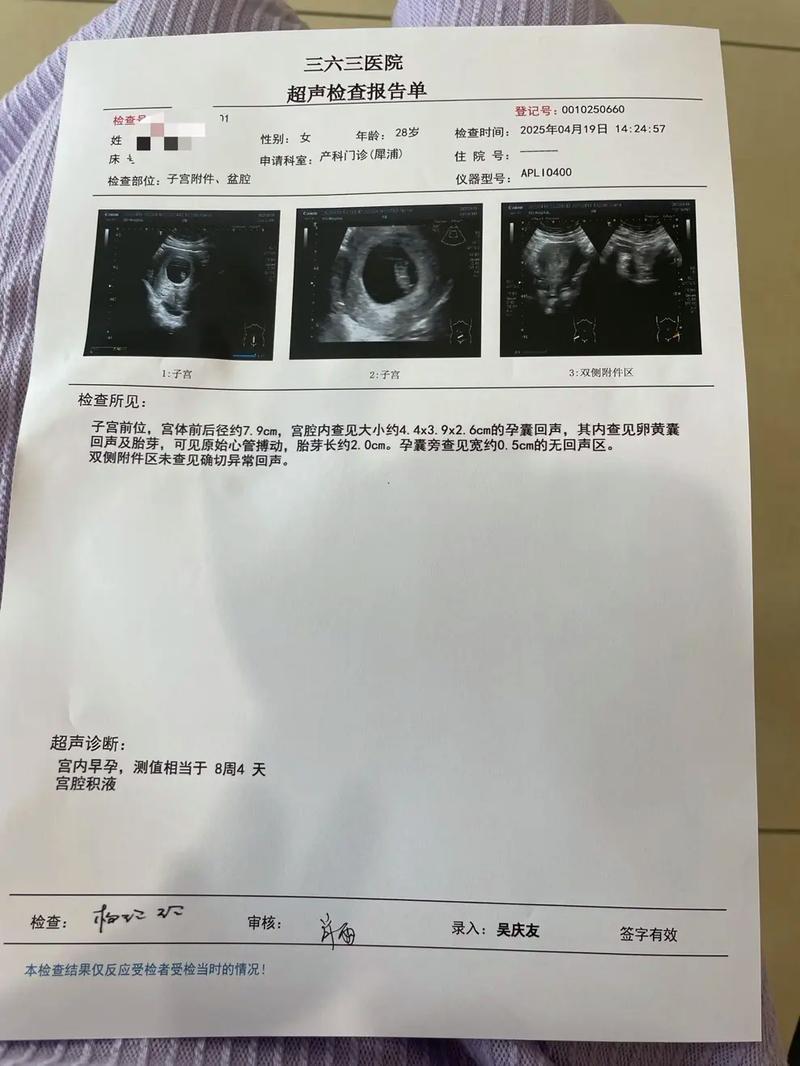 孕期做8次彩超是否必要？频繁检查对胎儿有影响吗？-第1张图片-郑州医学网