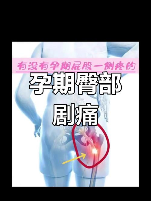 怀孕期间为什么屁股疼-第2张图片-郑州医学网
