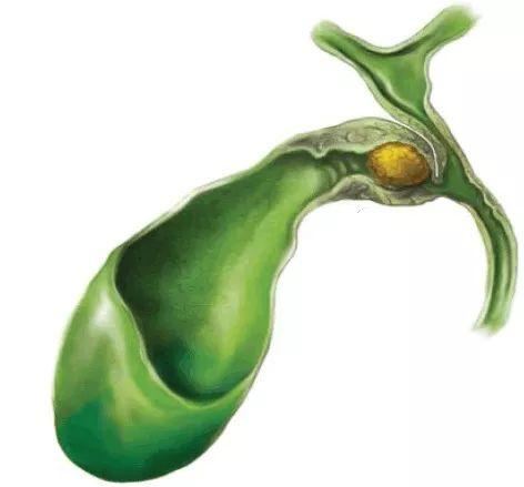 安纽希奶粉致儿童结石-第2张图片-郑州医学网