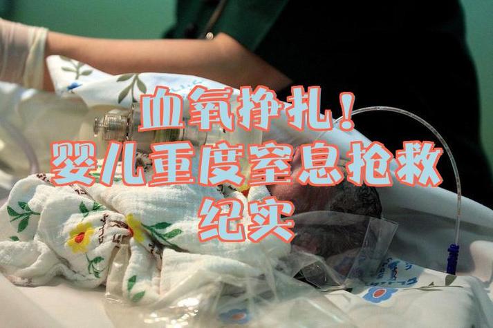 新生儿重度窒息一小时-第1张图片-郑州医学网