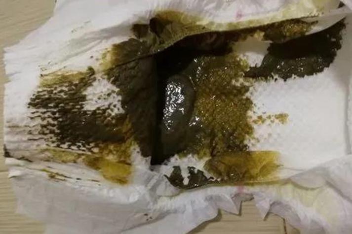 新生儿一下午没有大便-第2张图片-郑州医学网