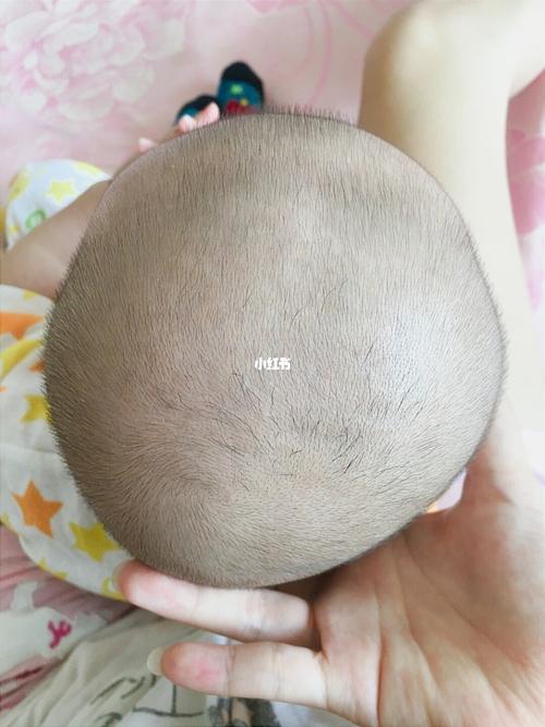 新生儿头喜欢往一边偏-第1张图片-郑州医学网