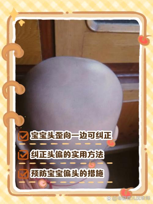 新生儿头喜欢往一边偏-第2张图片-郑州医学网