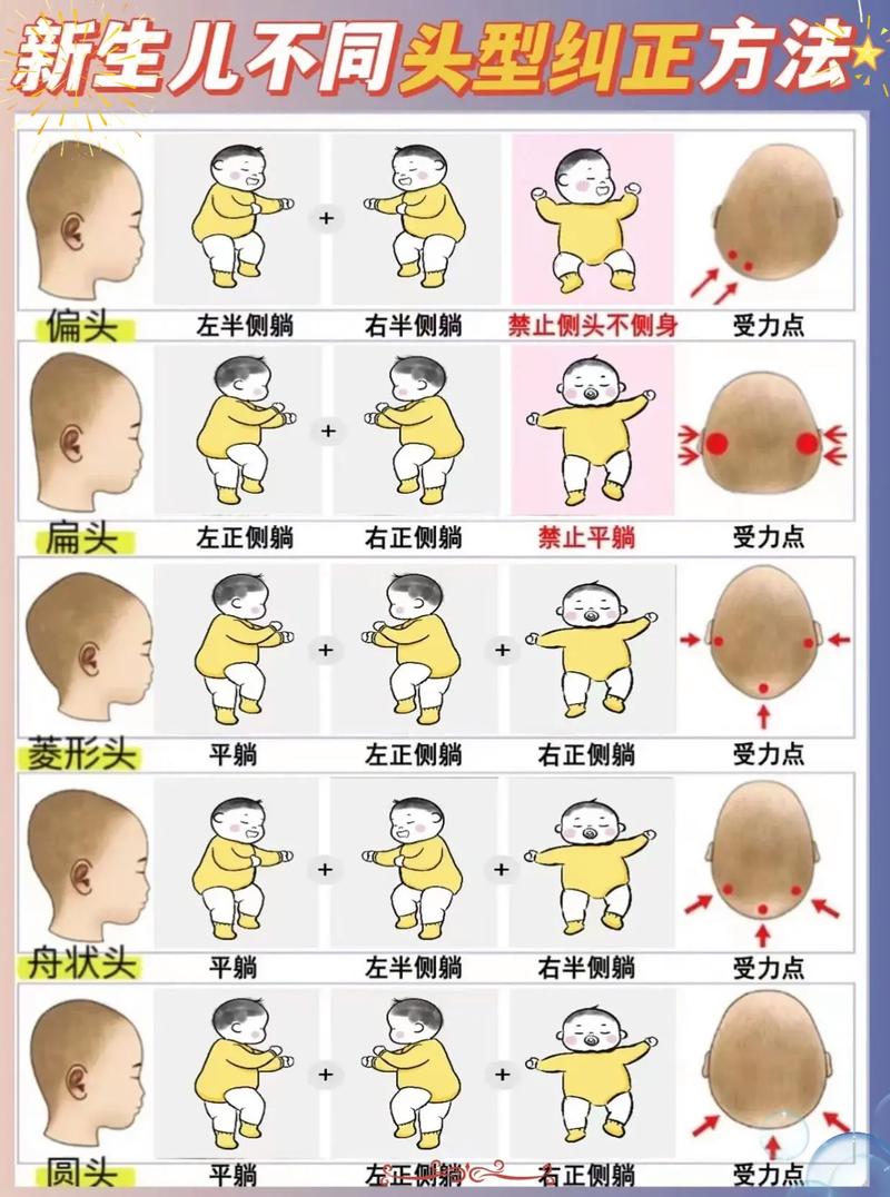 新生儿头喜欢往一边偏-第3张图片-郑州医学网