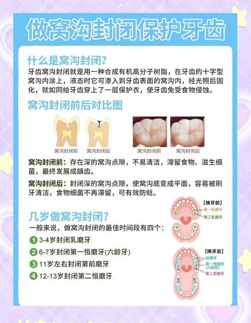 儿童龋齿有哪些科学有效的治疗方法，不同年龄段的孩子该如何选择？-第1张图片-郑州医学网