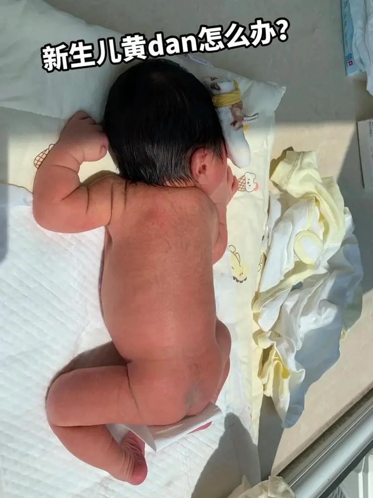 新生儿黄疸第五天12mg/dl需要干预吗?后续护理要注意什么?-第2张图片-郑州医学网 新生儿黄疸第五天12mg/dl需要干预吗?后续护理要注意什么?-第2张图片-郑州医学网