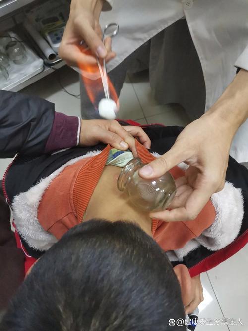 儿童咳嗽拔罐图片大全-第2张图片-郑州医学网 儿童咳嗽拔罐图片大全-第2张图片-郑州医学网