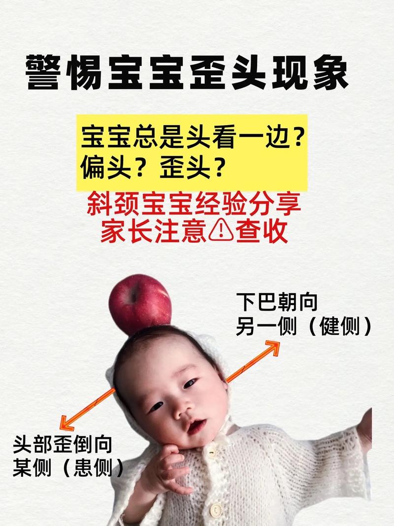 新生儿头喜欢偏向一侧-第1张图片-郑州医学网 新生儿头喜欢偏向一侧-第1张图片-郑州医学网