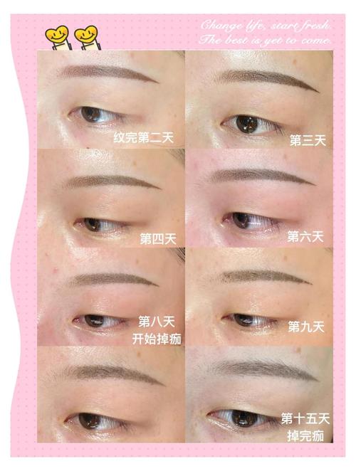 怀孕期间可以绣眉毛吗-第2张图片-郑州医学网 怀孕期间可以绣眉毛吗-第2张图片-郑州医学网