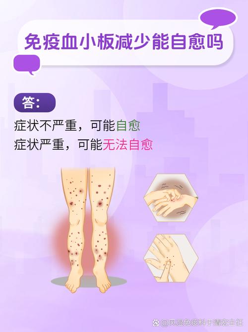 儿童血小板减少会怎样-第1张图片-郑州医学网 儿童血小板减少会怎样-第1张图片-郑州医学网