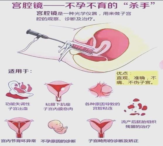 怀孕期间能检查宫颈吗-第1张图片-郑州医学网 怀孕期间能检查宫颈吗-第1张图片-郑州医学网