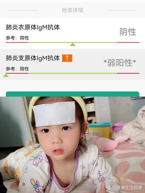 儿童支原体肺炎的疗程-第1张图片-郑州医学网