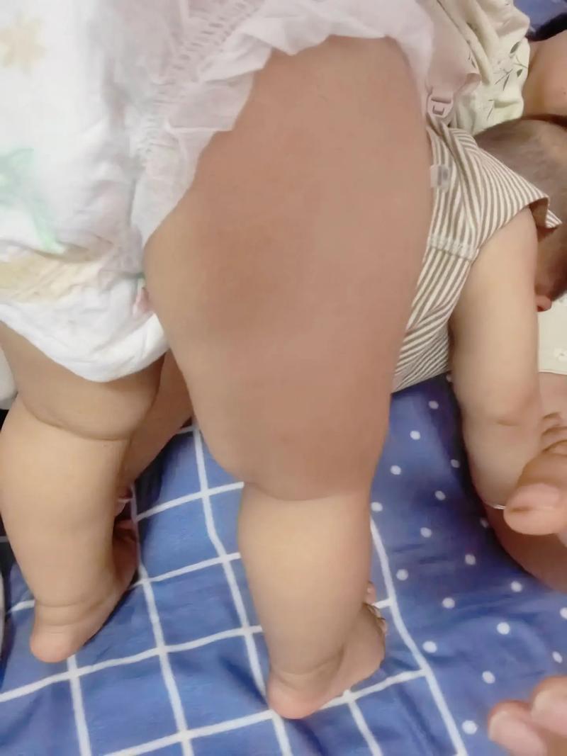 新生儿吃完奶一直格斗-第1张图片-郑州医学网