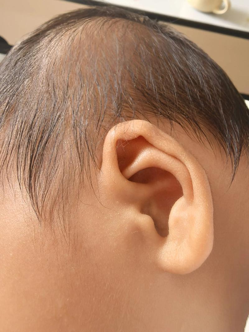 新生儿第三天听力未通过，是正常现象还是需干预的信号？-第1张图片-郑州医学网