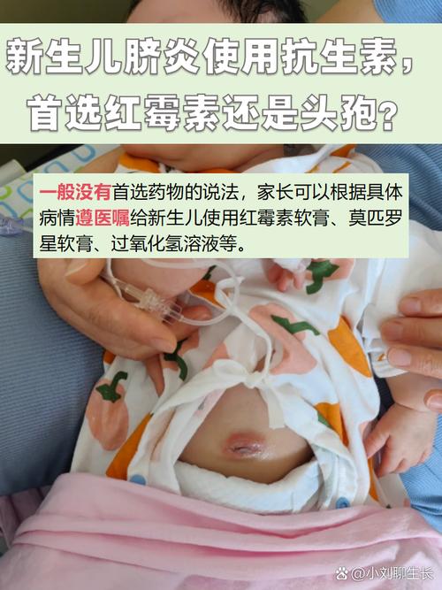 新生儿脐炎的病因、症状与护理要点有哪些？-第2张图片-郑州医学网