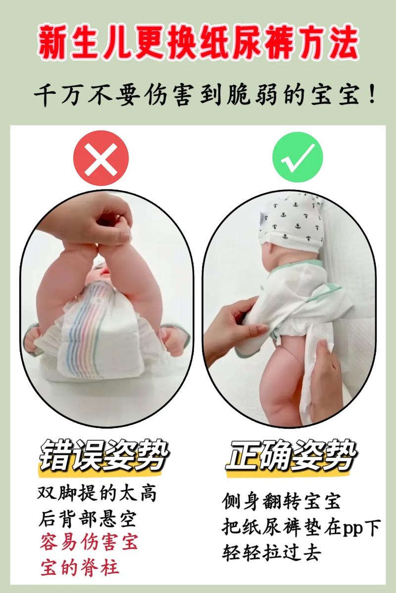 新生儿什么时候换尿裤-第2张图片-郑州医学网