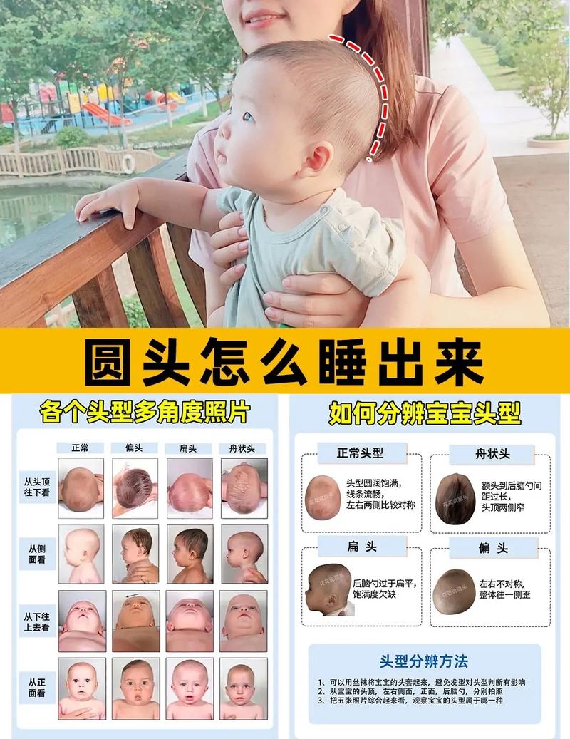 新生儿一定要睡头型吗-第3张图片-郑州医学网