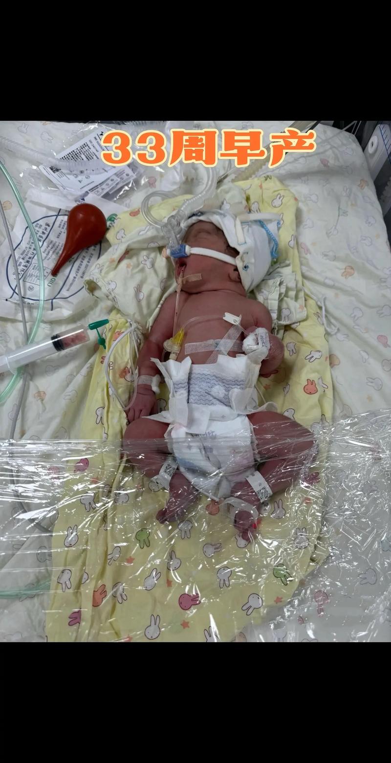 36周新生儿进保温箱,是早产儿必须的吗?家长要注意什么?-第1张图片-郑州医学网 36周新生儿进保温箱,是早产儿必须的吗?家长要注意什么?-第1张图片-郑州医学网