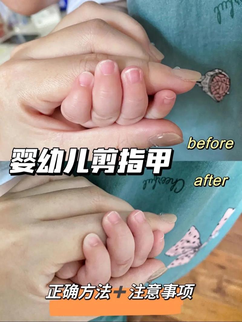 新生儿手指甲需要剪吗-第1张图片-郑州医学网
