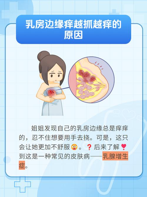 孕期乳房胀痛痒怎么办-第1张图片-郑州医学网