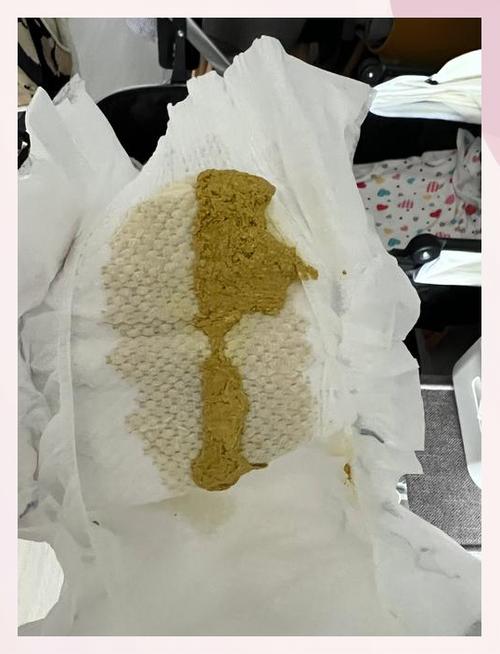 新生儿水便分离是腹泻吗？崔玉涛教你如何区分正常与异常便便？-第1张图片-郑州医学网