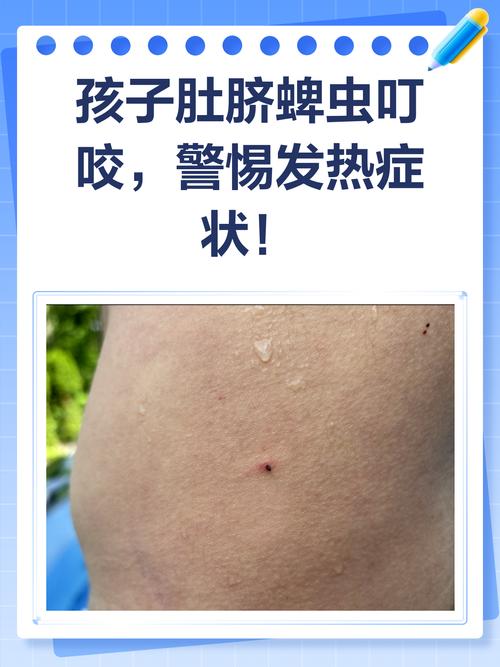 儿童肚子有虫子的视频-第2张图片-郑州医学网