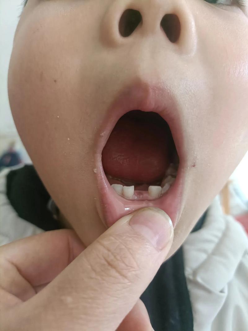 儿童梦见掉牙是身体信号还是心理暗示？背后隐藏哪些成长秘密？-第1张图片-郑州医学网