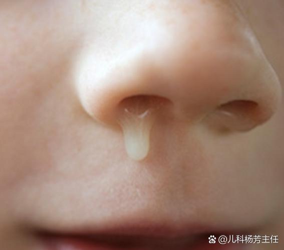 新生儿喝奶鼻子有鼻涕-第1张图片-郑州医学网