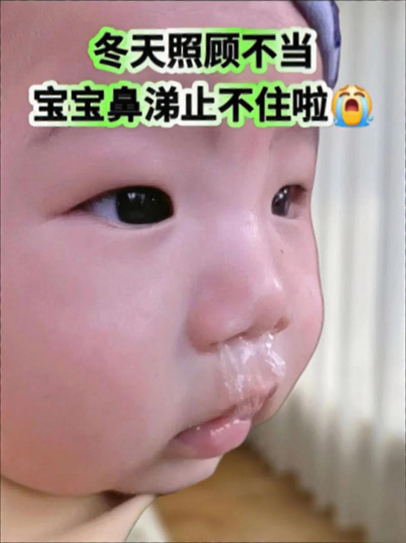 新生儿喝奶鼻子有鼻涕-第2张图片-郑州医学网