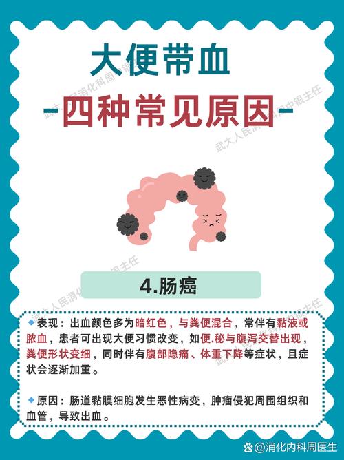 孕期大便带血怎么回事-第1张图片-郑州医学网