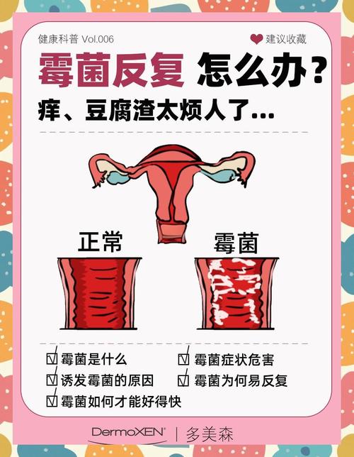 备孕期霉菌复发怎么办-第1张图片-郑州医学网