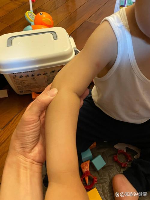 新生儿左胳膊抬不起来-第1张图片-郑州医学网 新生儿左胳膊抬不起来-第1张图片-郑州医学网