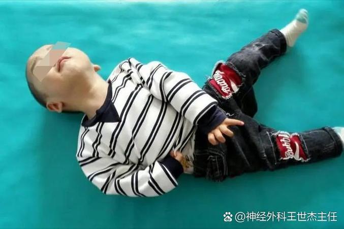 新生儿左胳膊抬不起来-第3张图片-郑州医学网 新生儿左胳膊抬不起来-第3张图片-郑州医学网