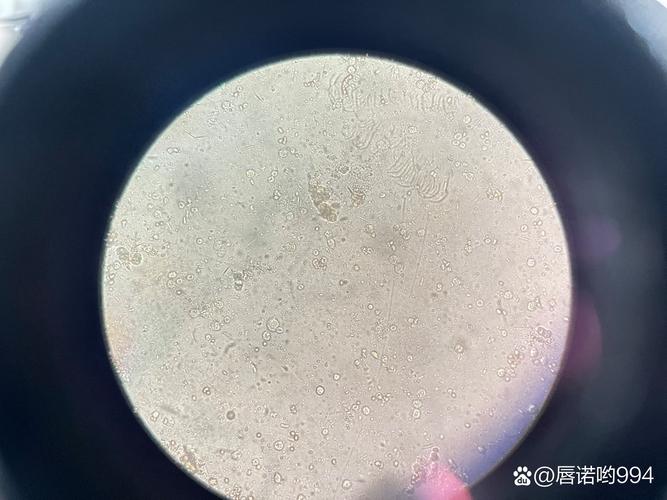 新生儿大便有白细胞是感染信号吗？家长该怎么应对？-第2张图片-郑州医学网