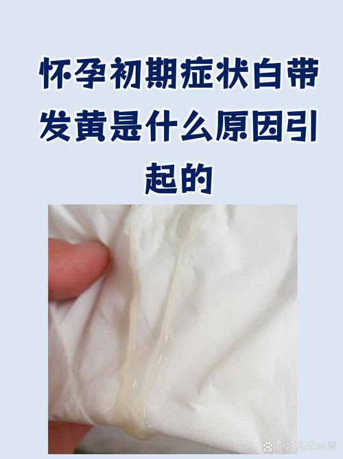 怀孕期白带有什么变化-第1张图片-郑州医学网