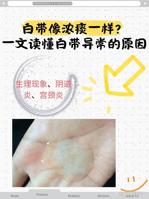 怀孕期白带有什么变化-第3张图片-郑州医学网