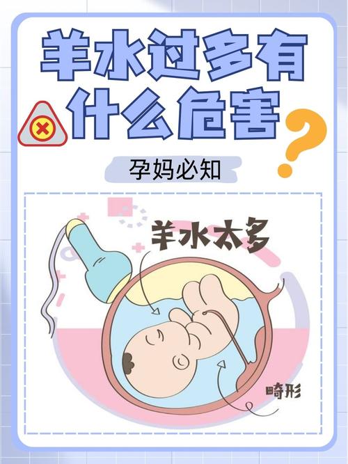 孕期羊水过多怎么办啊-第1张图片-郑州医学网