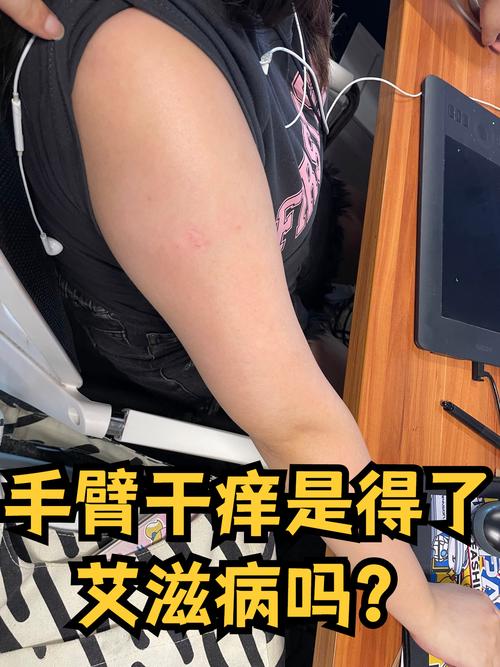 孕期手臂痒是皮肤问题还是激素变化？需要警惕哪些潜在风险？-第2张图片-郑州医学网