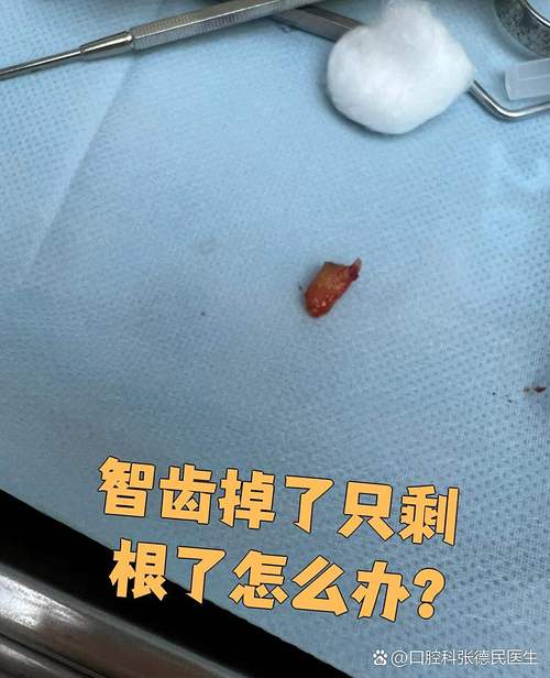 儿童牙齿掉了牙根还在，是正常现象还是隐藏口腔问题？-第2张图片-郑州医学网