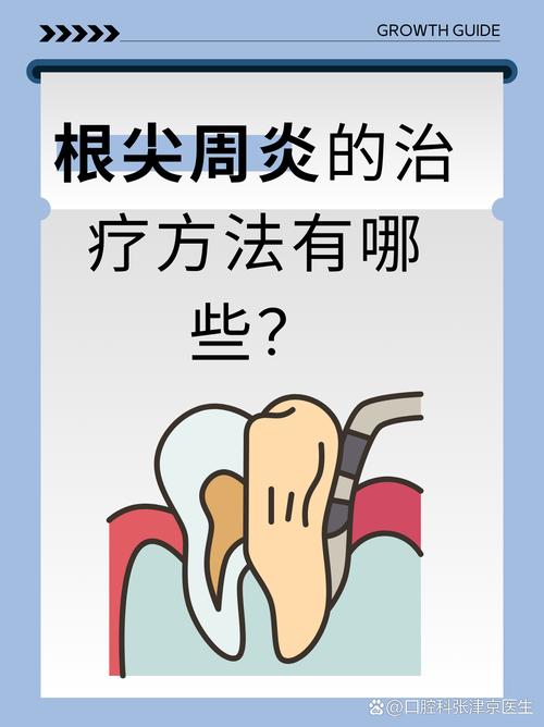 急性根尖炎孕期怎么治-第2张图片-郑州医学网