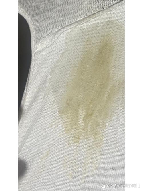 怀孕期间白带发黄发绿是感染了吗？对胎儿有影响吗？-第1张图片-郑州医学网