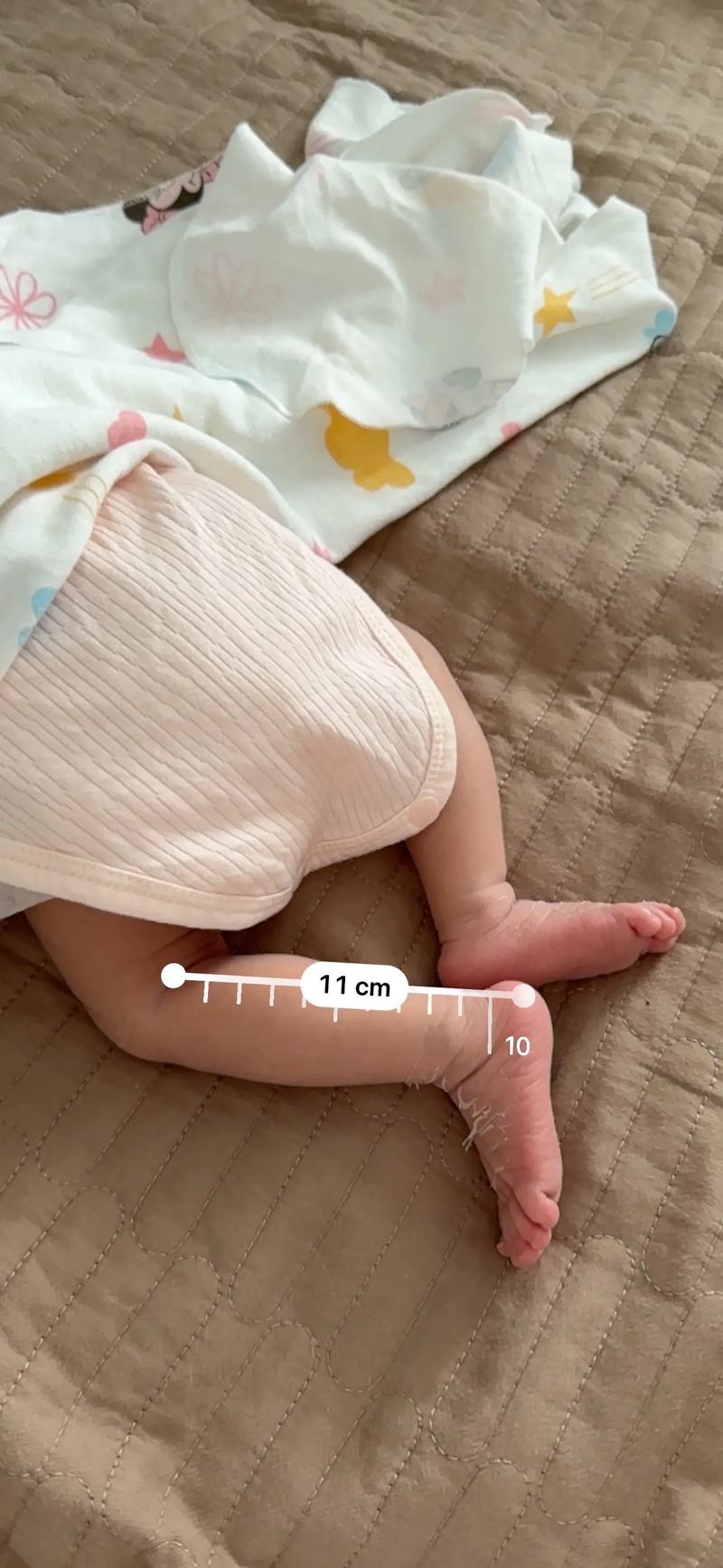 新生儿拍屁股哄睡真的好吗？这样做会影响脊椎发育或养成依赖吗？-第2张图片-郑州医学网